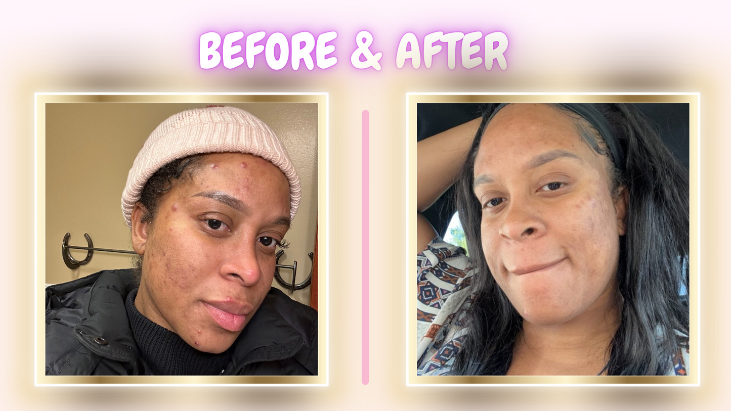 Turmeric & Kojic Acid Brightening Pads