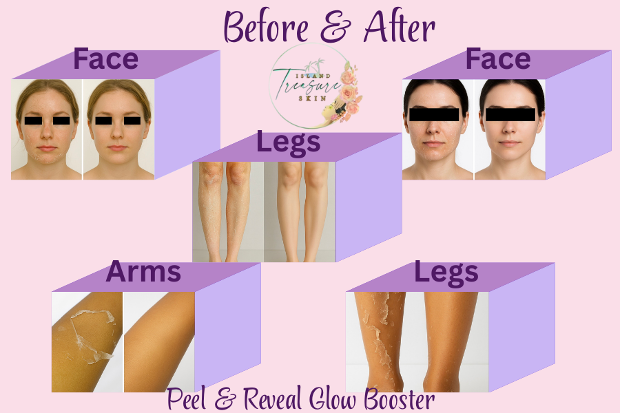 Peel & Reveal Glow Booster